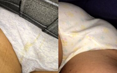 制服女子11：ロコモコ